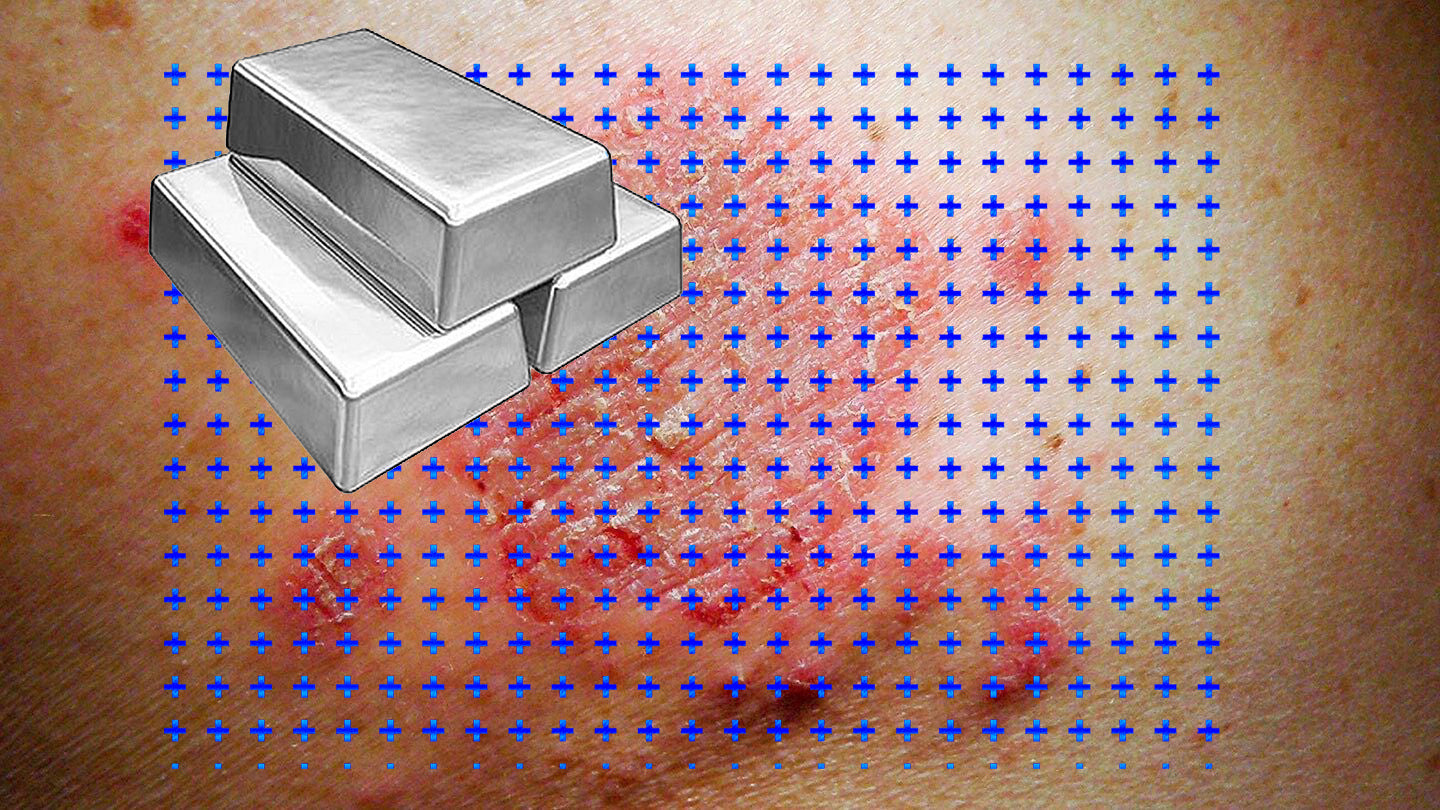 Colloidal Silver Gel